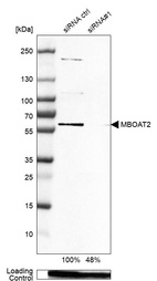 Anti-MBOAT2 Antibody