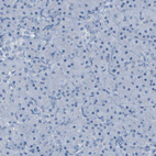 Anti-SLC12A1 Antibody