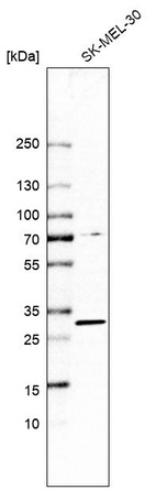 Anti-TP53RK Antibody