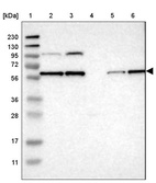Anti-PPM1B Antibody