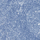 Anti-SLC16A10 Antibody