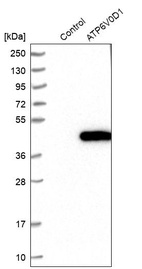 Anti-ATP6V0D1 Antibody