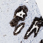 Anti-CMTM1 Antibody