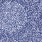 Anti-ATP6V0A4 Antibody