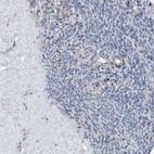 Anti-HTR1A Antibody