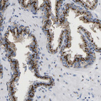 Anti-TMEM87A Antibody