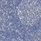 Anti-SFXN2 Antibody