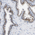 Anti-TMEM87A Antibody