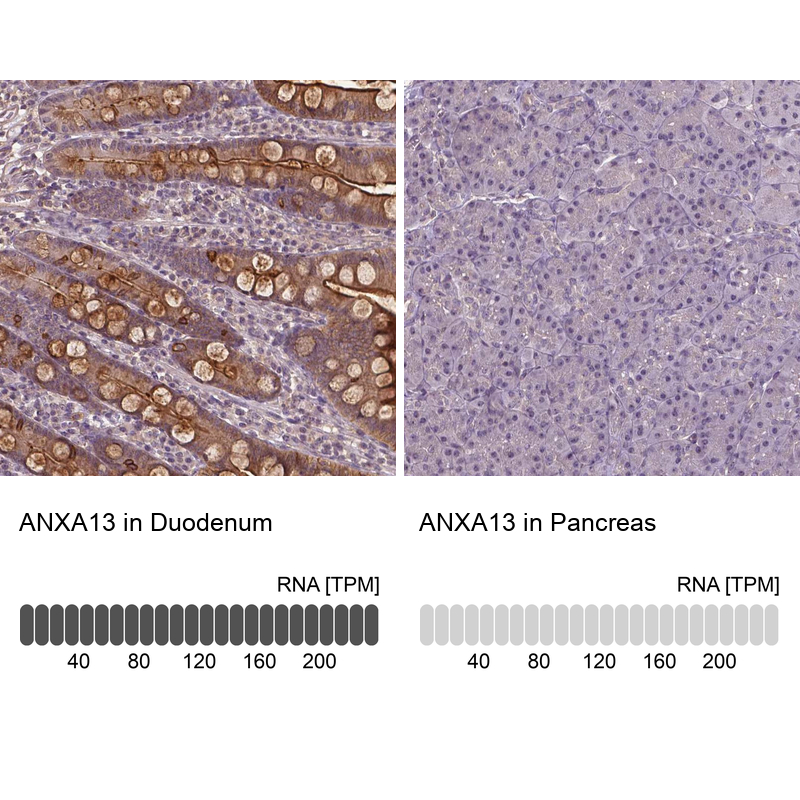 Anti-ANXA13 Antibody
