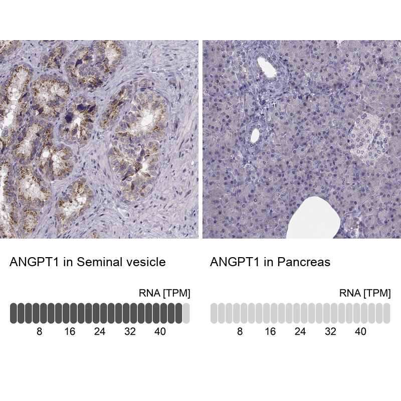 Anti-ANGPT1 Antibody