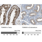 Anti-TOMM34 Antibody