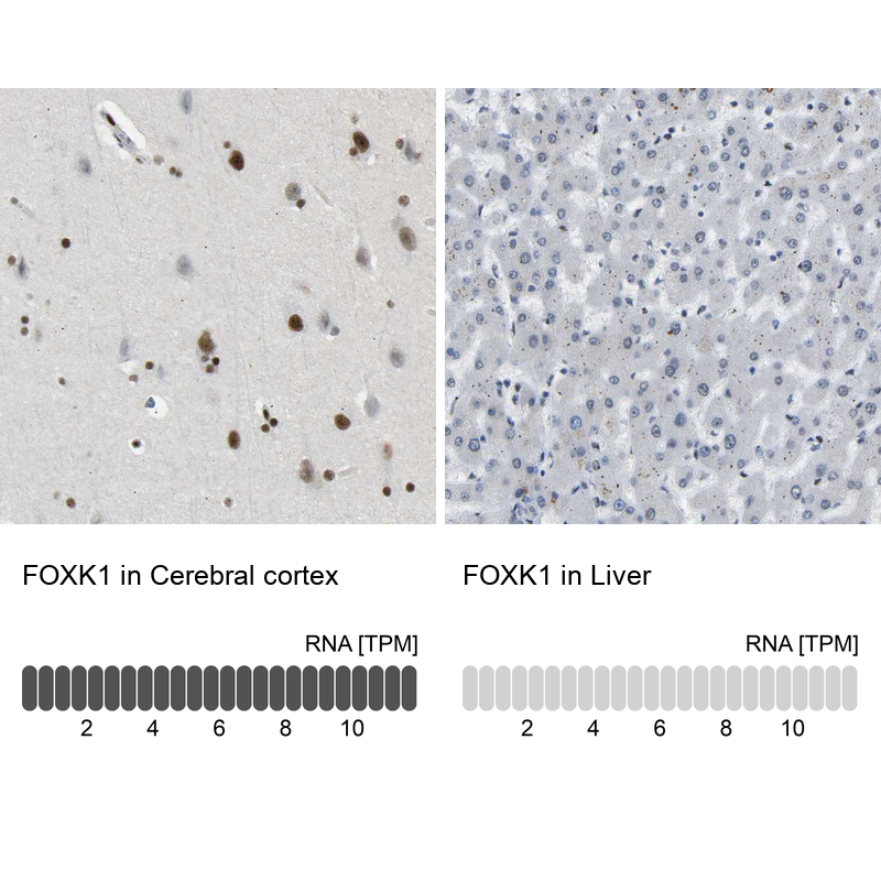 Anti-FOXK1 Antibody