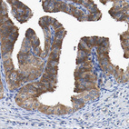 Anti-CCDC6 Antibody