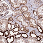Anti-NEK3 Antibody