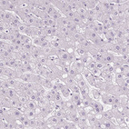 Anti-SLC45A3 Antibody