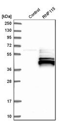 Anti-RNF115 Antibody