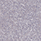 Anti-HCN1 Antibody