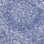 Anti-SLC35F1 Antibody