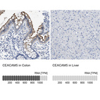 Anti-CEACAM5 Antibody
