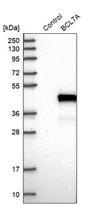 Anti-BCL7A Antibody