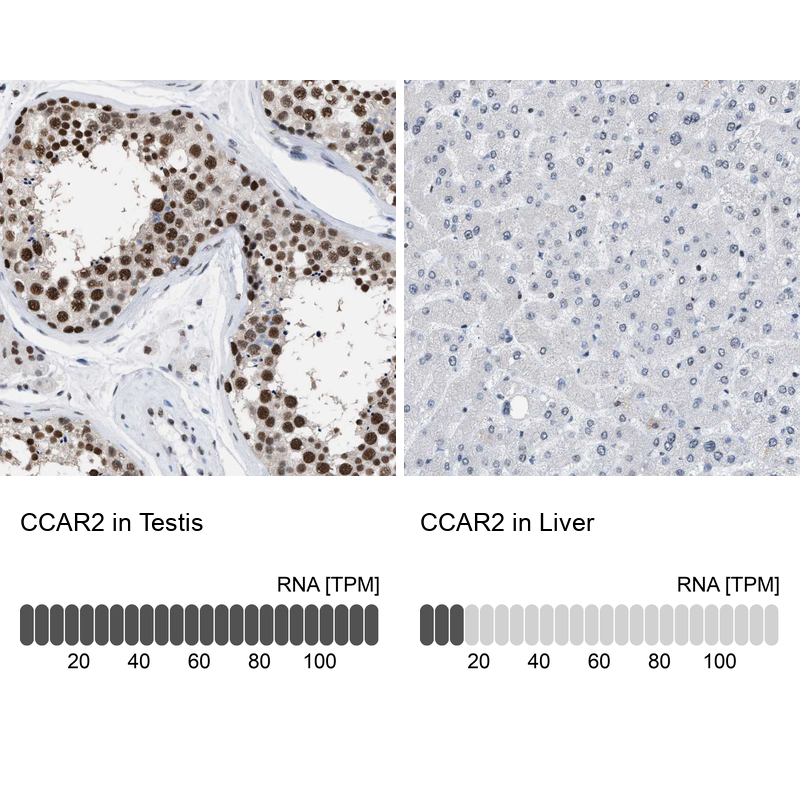 Anti-CCAR2 Antibody
