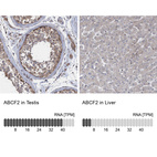 Anti-ABCF2 Antibody