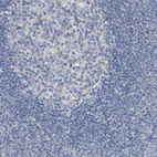 Anti-KLHDC10 Antibody