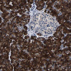Anti-SLC12A2 Antibody