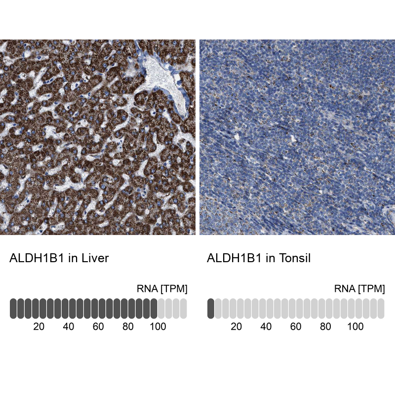 Anti-ALDH1B1 Antibody