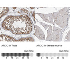 Anti-ATXN2 Antibody