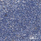 Anti-HSD17B4 Antibody