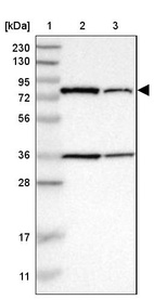 Anti-HSD17B4 Antibody