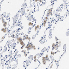 Anti-LRWD1 Antibody