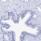 Anti-INSL6 Antibody