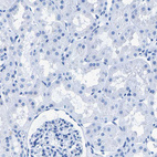 Anti-CPS1 Antibody
