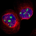 Anti-CPS1 Antibody