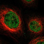 Anti-NPLOC4 Antibody