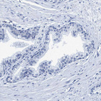 Anti-DNAI1 Antibody
