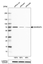 Anti-CDK5RAP3 Antibody