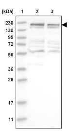 Anti-CDC42BPB Antibody