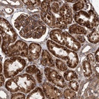 Anti-SLC25A10 Antibody