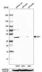 Anti-IDO1 Antibody