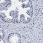 Anti-SLC28A3 Antibody