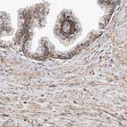 Anti-MRPL45 Antibody