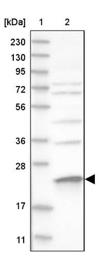 Anti-MRPS23 Antibody