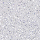 Anti-CAPN2 Antibody