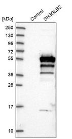 Anti-SH3GLB2 Antibody