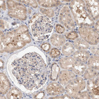 Anti-MRPL37 Antibody