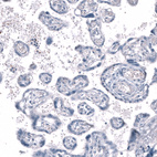 Anti-SLC10A5 Antibody