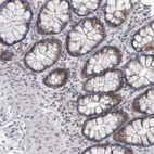 Anti-PSMB2 Antibody